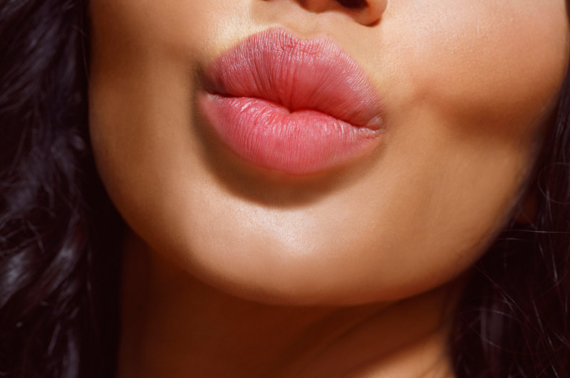 Woman-puckering-her-lips-after-Restylane-Kysse-treatment