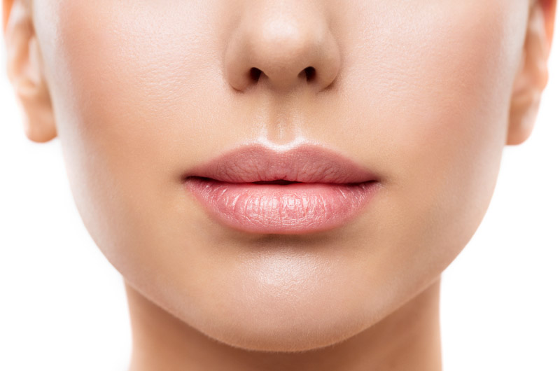 Woman-with-full-lips-after-treatment-with-JUVÉDERM®-ULTRA-XC-and-ULTRA-PLUS-XC
