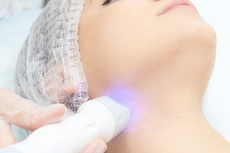 Woman-receiving-laser-facial-treatments-in-Ladera-Ranch
